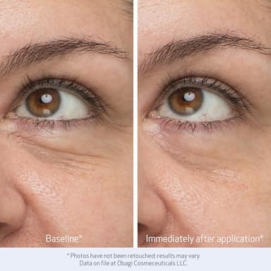 Obagi Daily Hydro-Drops Rejuvenating Eye Gel Cream – Reduces the Appearance of Dark Circles & Instantly Brightens, Smooths, & Depuffs Eyes – 0.5 oz - Image 4