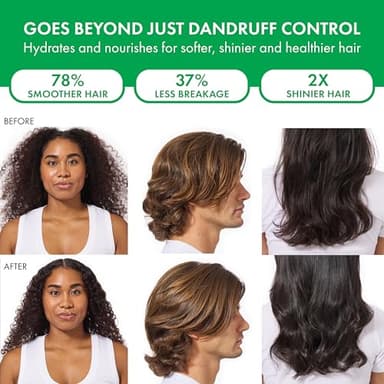 Dercos Anti Dandruff Shampoo, Dry Scalp Treatment and Itch Relief. Prescription Strength Comparable to 2% Ketoconazole, for Mild to Severe Dandruff-Prone Hair & Flaky, Itchy Scalps, 13.5 Fl. Oz. - Image 6