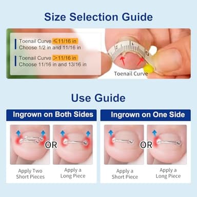 Nitinol Ingrown Toenail Corrector,at Home Ingrown Toenail Treatment,Curved Toenail Straightener,Ingrown Toe Nail Relief，Ingrown Toenail Removal Kit (11/16 In,13/16 In) - Image 6