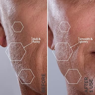 Michael Todd Beauty - Sonicsmooth – SONIC Technology Dermaplaning Tool - 2 in 1 Women’s Facial Exfoliation & Peach Fuzz Hair Removal System with 8 Weeks of Dermaplaning Blades - Image 5