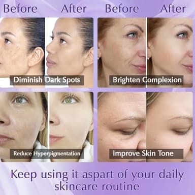 YRNVK Dark Spot Remover for Face Cream, Dark Spot Corrector, Rapid Tone Repair Retinol Serum for Sun Spots, Age Spots, Skin Brown, Melasma Skin Care with Upgraded Formula Vitamin C for Women 1.7 Fl OZ - Image 3