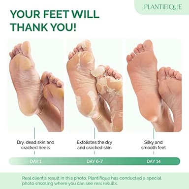 PLANTIFIQUE Foot Peeling Mask 4 Pack | Dermatologically Tested Repairs Heels & Removes Dry Dead Skin for Baby Soft Feet | Exfoliating Foot Peel Mask for Dry Cracked Feet - Image 2