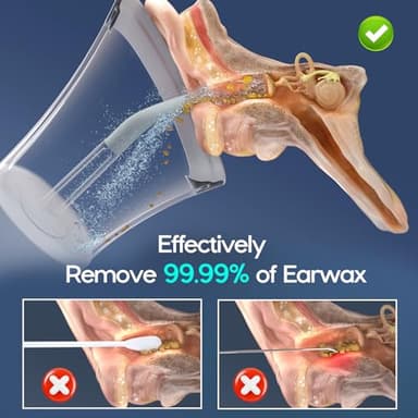 Ear Wax Removal Kit, 5modes Ear Cleaning Tool Dark Grey - Image 2