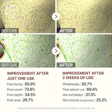 Peel Shot Glow Rice Ampoule Duo White rice ampoule+Black rice ampoule Soft Exfoliating Face and Body Scrub Dead Skin Cells, Blackheads Remover for All Skin Types - Image 7