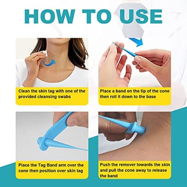 Skin Tag Remover, FDA-Cleared Skin Tag Removal Kit Device, Safe and Effective Home Use (Yellow) - Image 4