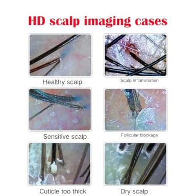 Professional Scalp Camera with 11-Inch HD Screen - High-Definition Hair & Scalp Analysis Device for Salons and Spas, Easy to Use with Memory Storage, Ideal for Scalp Treatments & Client Consultations - Image 6