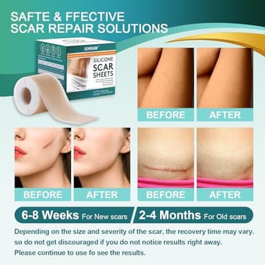 Medical Grade Silicone Scar Sheets, Silicone Scar Tape (1.6”x 60” Roll-1.5M), Professional Scar Removal Treatment, Reusable Silicone Scar Strip for Keloid, C-Section, Surgery, Burns, Acne Etc - Image 5