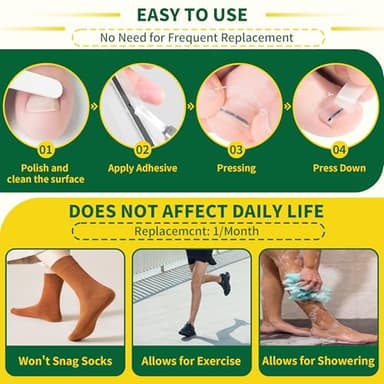 Large Size-Titanium Alloy Ingrown Toenail Treatment & Removal Kit for Quick Relief, Ingrown Toenail Removal Kit, Professional Ingrown Toenail Corrector, Ingrown Toenail Tools for Quick Relief, 10 Pcs - Image 5