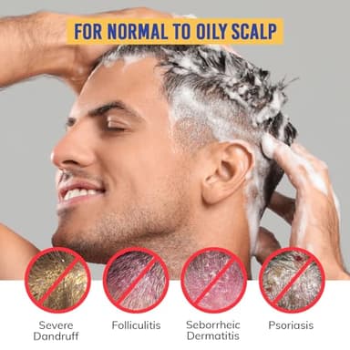 Seborrheic Dermatitis & Folliculitis Dandruff Shampoo: Anti Fungal Medicated Shampoo for Scalp Problems with Selenium Sulfide & Botanical Extracts - Flakes Itchy & Oily Scalp Relief Mint Breeze - Image 2