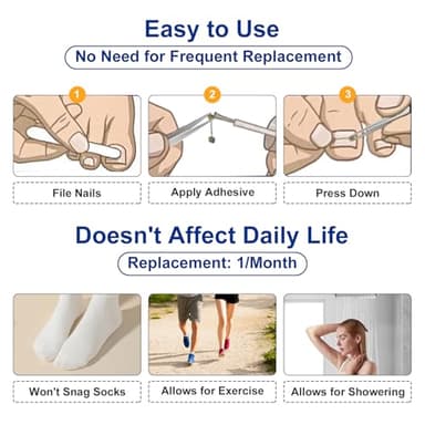 Nitinol Ingrown Toenail Corrector,at Home Ingrown Toenail Treatment,Curved Toenail Straightener,Ingrown Toe Nail Relief，Ingrown Toenail Removal Kit (11/16 In,13/16 In) - Image 5