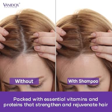Vanidox Tea Tree Shampoo and Conditioner Set with Lavender and Mint | DHT Blockers | With 100% Pure Tea Tree Oil for Itchy, Dry Scalp | Sulfate & Paraben Free | For Men & Women | 16 fl oz Each - Image 7