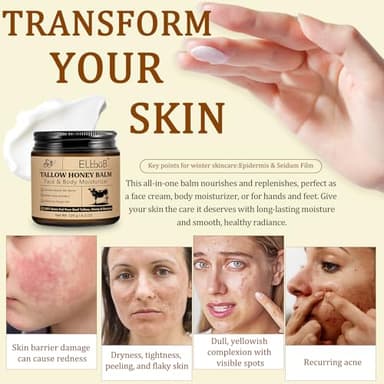 ELBBUB Whipped Tallow Cream for Face & Body - 100% Grass-Fed Beef Tallow, Natural Honey & Beeswax Moisturizer, Deep Hydration & Nourishment, Oil-Free & Unscented, Fast Absorbing - Image 3