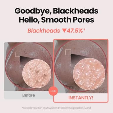 [K-Beauty] Rose Vitamin Oil to Foam - All-in-One Korean Face Wash OilBased Foaming Facial Cleanser - Pore Minimizing & Blackhead Remover - Makeup Deep Cleansing Oil for All Skin Types (3.88 fl oz) - Image 4