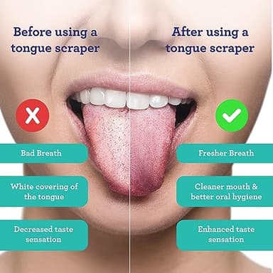 GuruNanda Tongue Scraper for Adults (2 Pack) with Travel Case, 420 Medical-grade 100% Stainless Steel Tongue Cleaner, Aids in Fresh Breath & Oral Care - Image 2