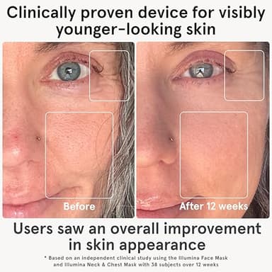 iRestore Red Light Therapy for Face - Anti Aging LED Face Mask for Youthful Radiant Skin with Reduced Wrinkles, Fine Lines - Red, Blue & Infrared Therapy Mask - Facial Skincare Device with 360 LEDs - Image 2