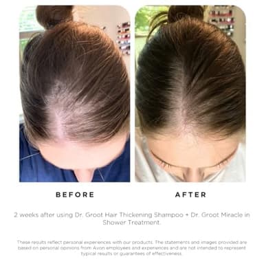 Dr. Groot Hair Thickening Shampoo, Korean Hair Care with Biotin, Rosemary Oil to Help Volumize Thinning, Damaged Hair, Hydrate Hair and Scalp, Biotin Shampoo, Scalp Revitalizing Solution - Image 5