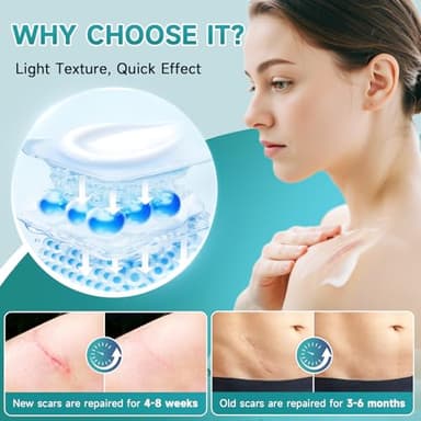 Pumkot Advanced Scar Cream, Silicone Gel for Scars, Professional Scar Removal Cream for Surgical Scars, Stretch Marks, Old and New Scars 1.7 oz(50ml) - Image 5