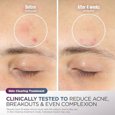 Shark CryoGlow LED Face Mask (FSA/HSA Eligible*) with Under-Eye Cooling, Anti-Ageing & Blemish Repair, Red & Blue LED, Infrared Light Therapy, USB-C, Remote Control, Storage Bag, Blue Frost, FW312 - Image 6