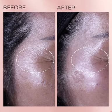 Elizabeth Arden Retinol + HPR Ceramide Rapid Skin Renewing Anti-Aging Face Serum Capsules, Fine Lines & Wrinkles Treatment with Peptides, Vitamin E, & Niacinamide, 90 Count - Image 9