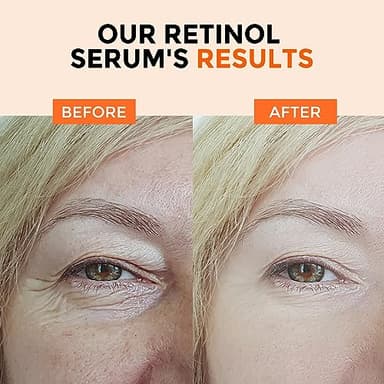 Retinol Serum for Face 2.5%, B5 Resurfacing Retinol Serum with Vitamin C, Vitamin E, Hyaluronic Acid, Niacinamide, Peptide for Anti-Aging, Wrinkle Smoothing, Dark Spot Corrector, Brighten Dullness - Image 5