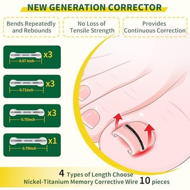 Large Size-Titanium Alloy Ingrown Toenail Treatment & Removal Kit for Quick Relief, Ingrown Toenail Removal Kit, Professional Ingrown Toenail Corrector, Ingrown Toenail Tools for Quick Relief, 10 Pcs - Image 6