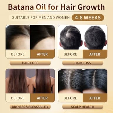 Batana Oil for Hair Growth, 100% Pure & Organic, Cold Pressed Traditional Palm Nut, Unrefined Hair Growth Oil Prevents Hair Loss - Image 5