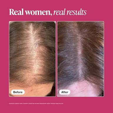 Viviscal Hair Growth Supplements for Women, Thicker Fuller Hair Support for Thinning Hair and Hair Loss, with Biotin and Marine Collagen, Drug-Free, 180 Tablets, 90-Day Supply - Image 5