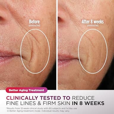 Shark CryoGlow LED Face Mask (FSA/HSA Eligible*) with Under-Eye Cooling, Anti-Ageing & Blemish Repair, Red & Blue LED, Infrared Light Therapy, USB-C, Remote Control, Storage Bag, Blue Frost, FW312 - Image 4