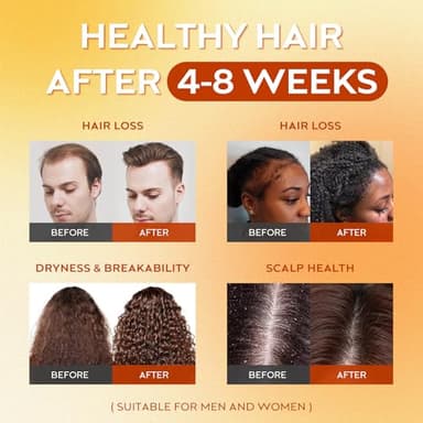 Batana Oil for Hair Growth Dr Sebi, 100% Raw Organic Batana Hair Mask from Honduras, Wild Growth Hair Oil, Scalp Oil Promotes Hair Thickness, Prevents Loss for Men & Women, 4.06 fl oz (1 Pack) - Image 4