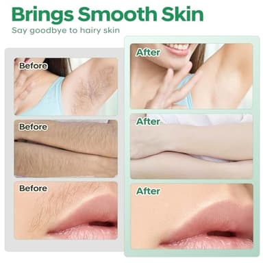 Wax Strips - Body Waxing Strips, Wax Kit for Women & Men - Brazilian Wax Kit, Back Waxing Kit, All Skin Types, Face, Arms, Legs, Armpits, Bikini, 98% Natural, Hypoallergenic Odourless, Green - Image 5