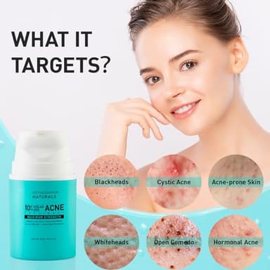 Acne Pimple Spot Treatment Cream: Cystic Hormonal Blackheads Blemish Breakouts for Face, Back and Body - 10% Azelaic Acid & Salicylic Acid - Teens-Adults, 1.8 oz - Image 2