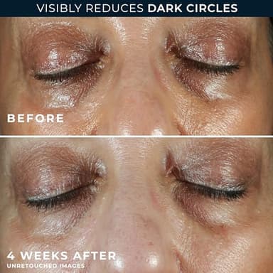 RoC Multi Correxion 5 in 1 Anti-Aging Eye Cream for Puffiness, Under Eye Bags & Dark Circles, Skin Care Treatment with Shea Butter, (.5 oz) with Night Cream Packette (Packaging May Vary) - Image 5