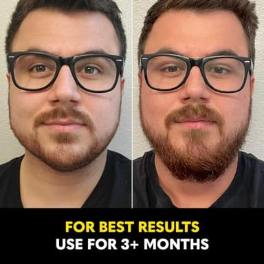 Beard Club - Beard Growth Serum with Natural Castor, Coconut and Avocado to Grow a Thicker, Fuller Beard, Fill in Patches and Stimulate Healthier Facial Hair Growth - Image 6