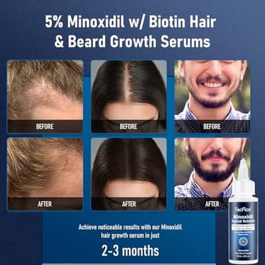 5% Minoxidil for Men Hair with Biotin, Minoxidil for Women,Tecflox Minoxidil Beard Growth Oil, Minoxidil Hair Growth Serum for Men,4-Pack,Total 8Fl Oz for 8 Months, Hair Growth Oil(White) - Image 2