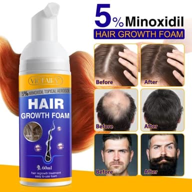5% Minoxidil Foam for Hair Growth and Thickening - Biotin & Minoxidil Treatment to Stop Thinning & Hair Loss for Men & Women, 2oz - Image 4