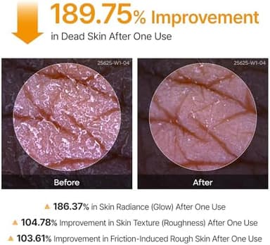 Dr.Melaxin Body Keratin Care Kojic Acid Turmeric Spray Gently Exfoliating Peeling Solution Korean Skincare All Skin Types 200ml - Image 8