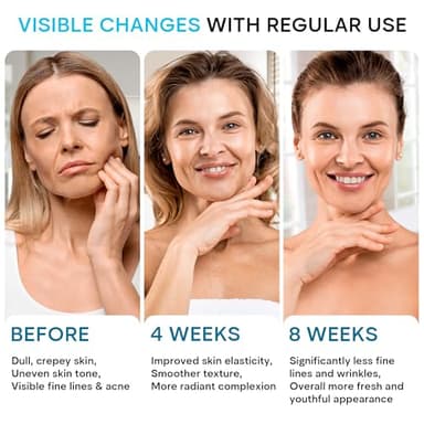 REMEDIAL PAX Face Moisturizer Retinol Cream, Anti Aging Neck Firming Cream, Collagen Day & Night Face Cream with Hyaluronic Acid for Women & Men, 1.85 Fl Oz - Image 5