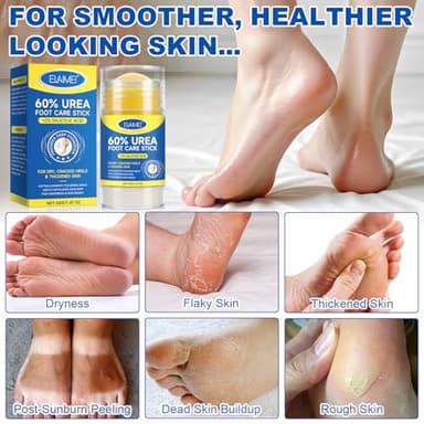 60% Urea Cream Stick plus 2% Salicylic Acid, Maximum Strength Urea Foot Cream Callus Remover for Dry Cracked Heels, Hands, Knees,Exfoliating Moisturizer, Dead Skin Remover Foot Balm 1.4oz (1pcs) - Image 7