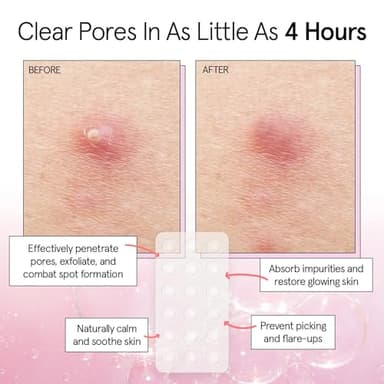 grace & stella Pimple Patches for Face (66 Dots) - Hydrocolloid Acne Patches for Face - Invisible Zit Stickers - Flatten Spots in 6-8 Hrs - Image 3