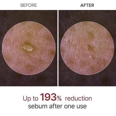Dr.Melaxin Peel Shot Glow Black Rice Peeling Ampoule, Soft Exfoliating Face and Body Scrub Dead Skin Cells, Blackheads Remover for All Skin Types korean skin care 80ml - Image 3