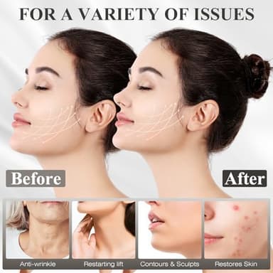 Juskaa Chin Strap for Sleeping,Double Chin Reducer,Adjustable Chin Strap,Jaw Strap,Jawline Shaper,V Line Lifting Mask,Black,M - Image 4