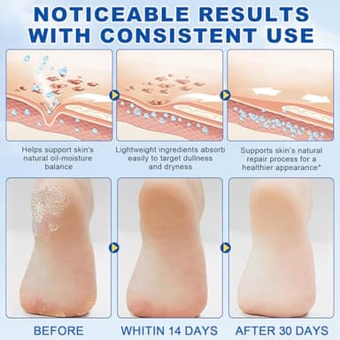 60% Urea Cream Stick plus 2% Salicylic Acid, Maximum Strength Urea Foot Cream Callus Remover for Dry Cracked Heels, Hands, Knees,Exfoliating Moisturizer, Dead Skin Remover Foot Balm 1.4oz (1pcs) - Image 4