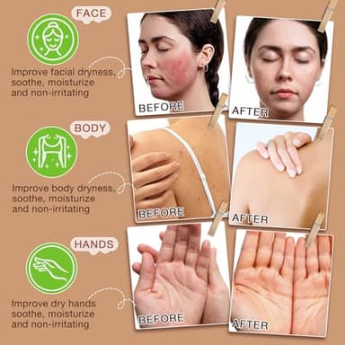 asusxcli Beef Tallow for Skin,Beef Tallow for Face,Beef Tallow and Honey Balm,Grass Fed Whipped Tallow Honey Balm,Natural Moisturizer Hydrates,Deeply Nourishes the Skin, Enhances Natural Radiance - Image 8