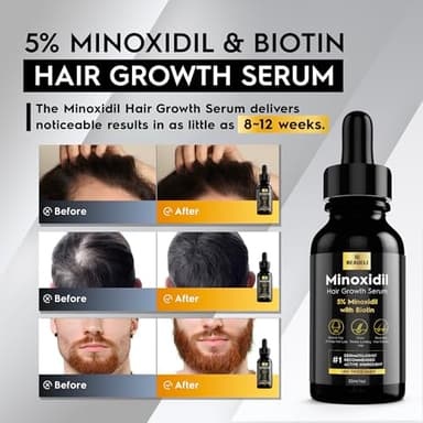 5% Minoxidil Hair Growth for Men and Women: Extra Strength Minoxidil Regrowth Treatment Serum for Thinning Hair Loss to Grow Thicker Fuller Faster 30ml 3Bottles - Image 2