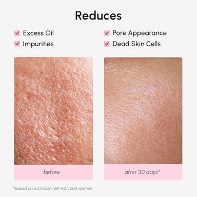 MAREE Pore Minimizer for Face Toner – Witch Hazel Toner with Niacinamide & Marine Collagen – Gentle Exfoliating Oil Control Facial Toner for Women – BHA Liquid Exfoliant – Alcohol Free Tonico Facial - Image 5