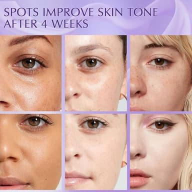 YRNVK Dark Spot Remover for Face Cream, Dark Spot Corrector, Rapid Tone Repair Retinol Serum for Sun Spots, Age Spots, Skin Brown, Melasma Skin Care with Upgraded Formula Vitamin C for Women 1.7 Fl OZ - Image 7