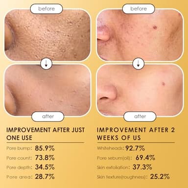 Peel Shot Glow Rice Ampoule Duo | White & Black Rice Exfoliant Face and Body Scrub with Hyaluronic Acid & Rice Extract | Facial Exfoliator, Pore Refining, Dead Skin Cells Remover - Image 5