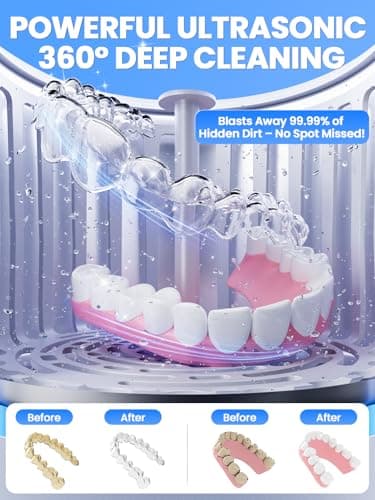 Dental Ultrasonic Retainer Cleaner Machine: Nicwell 200ML Denture Cleaner, Deep Cleaning Mouth Guard Cleaner, Aligner Cleaner, NightGuard Cleaner with Protection Design for Braces, Oral Dental & Tray - Image 2