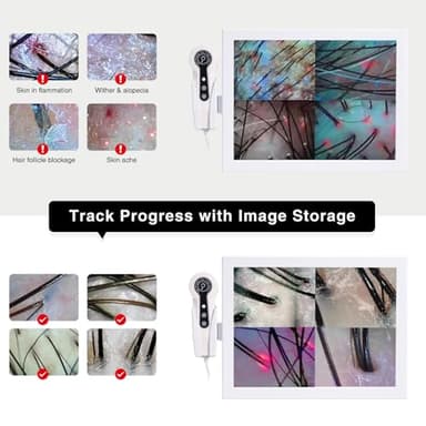 Professional 15-Inch Scalp Camera for Beauty Salons – High-Resolution Hair and Scalp Analysis Device with Image Storage, Easy Assembly, Durable Build, Ideal for Client Consultations & Head Spa - Image 6