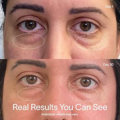 Solawave Red Light Therapy Mask for Eyes | Skincare Device for Under Eye Bags, Crow’s Feet, Forehead Lines | Reduces Appearance of Wrinkles, Sagging, Dark Circles, & Puffiness | 3 Minute Treatment - Image 4